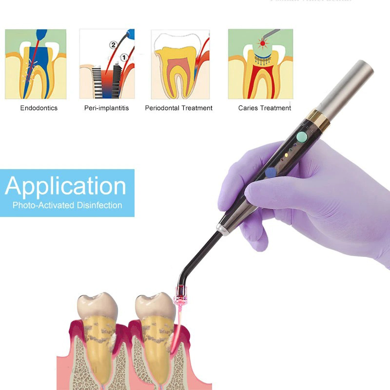 Wireless F3WW Dental Diode Las - Industrial Laser Alignment Tool 评论和价格